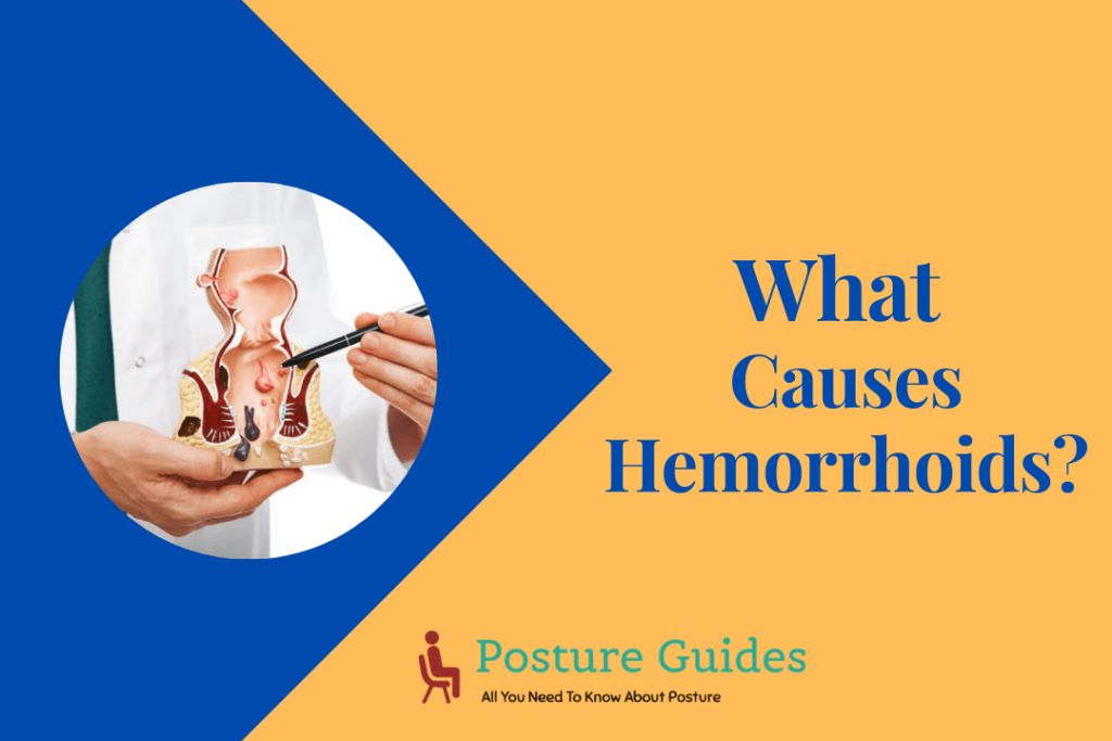 What-Causes-Hemorrhoids-2